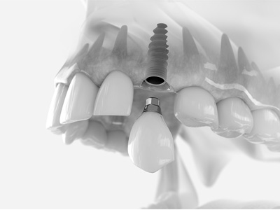 Tratamentos Odontológicos em Belo Horizonte