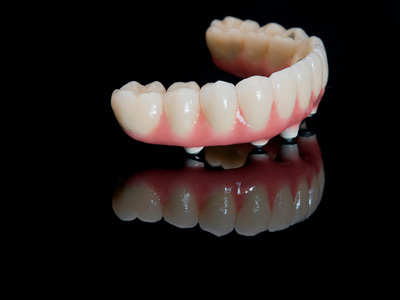 Tratamentos Odontológicos em Belo Horizonte
