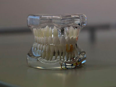 Tratamentos Odontológicos em Belo Horizonte