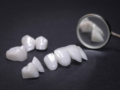 Tratamentos Odontológicos em Belo Horizonte